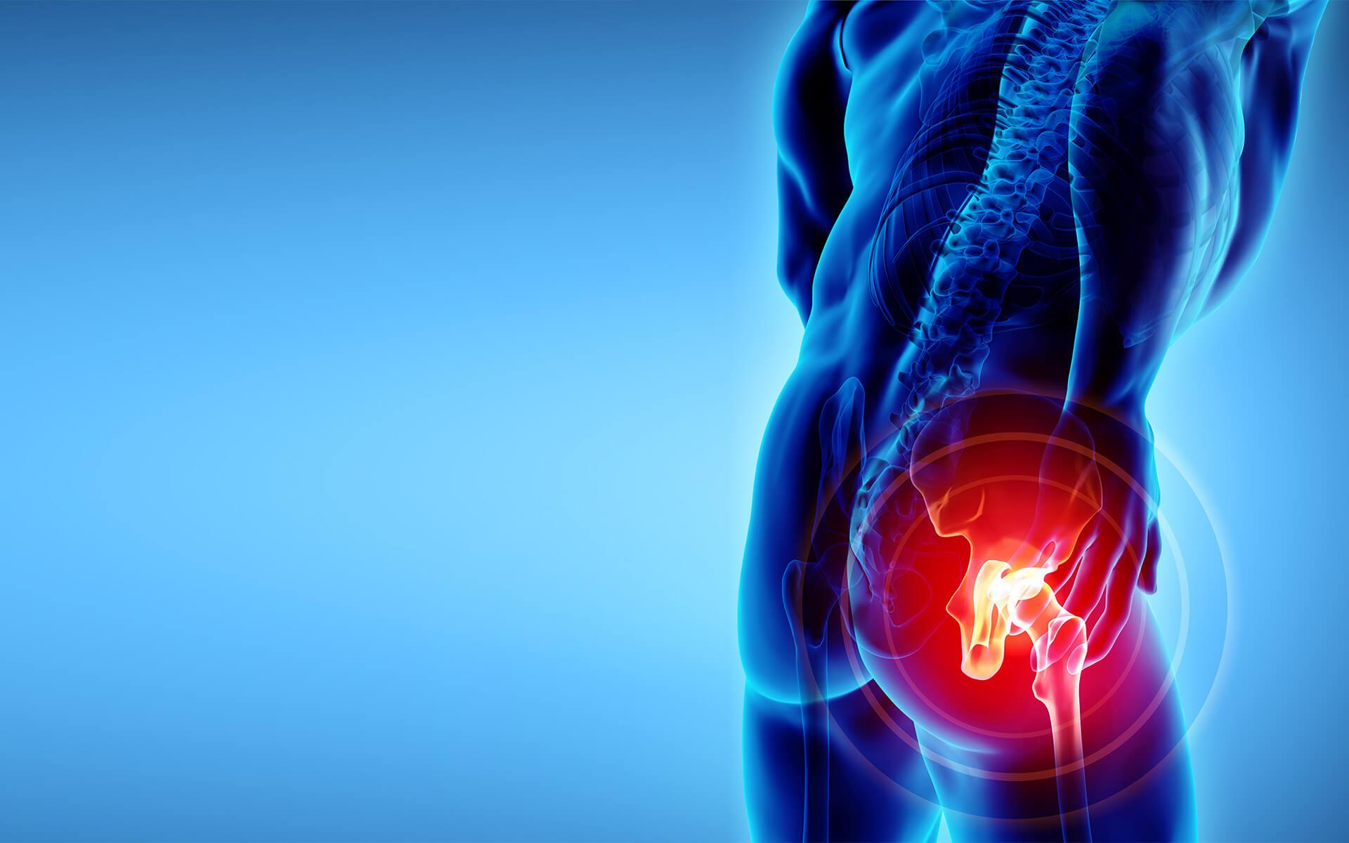 Should You Walk with Avascular Necrosis? Safe Movement & AVN Treatment Without Surgery